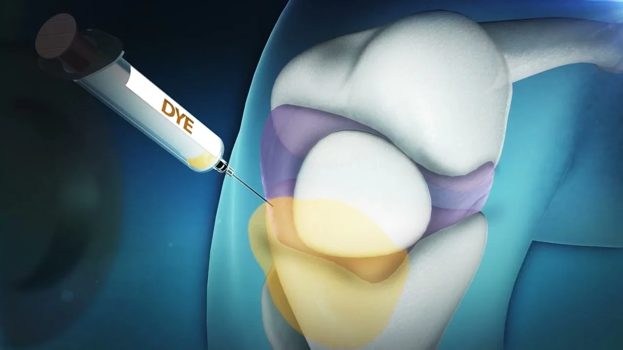 Patient Educational Video preview